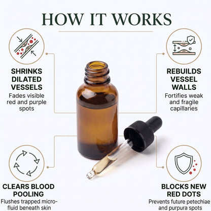 Vascure Relief™